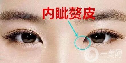 開(kāi)內(nèi)外眼角的區(qū)別,開(kāi)內(nèi)眼角,開(kāi)外眼角