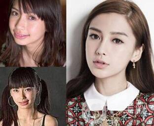 有沒有可能Angelababy不做整容手術(shù)就改變了這么多？