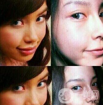 有沒有可能Angelababy不做整容手術(shù)就改變了這么多？