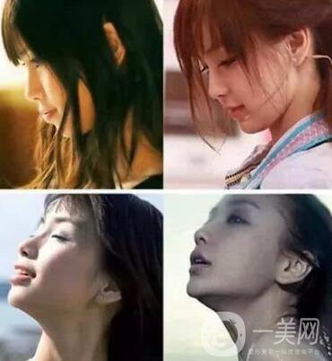 有沒有可能Angelababy不做整容手術(shù)就改變了這么多？