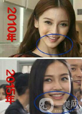 有沒有可能Angelababy不做整容手術(shù)就改變了這么多？