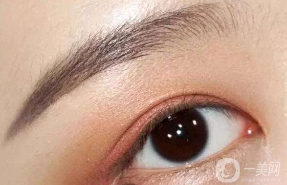 上眼皮吸脂價(jià)格,雙眼皮