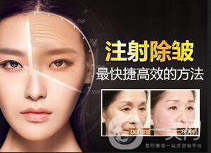 去除抬頭紋風險,去除抬頭紋方法