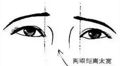 開眼角疼嗎？這幾種情況開眼角*果堪比換頭！