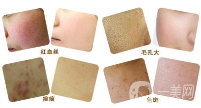 彩光嫩膚好嗎？*果如何？