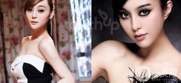 整形手術是一項不可能完全把你復制稱為別人的手術，因為你們是兩個有著完全不同的身體。影響外表的因素有很多，包括體型、皮膚狀況、總體健康和骨骼結構。此外，整容手術完成后的愈合*果也會因人而異，這也是為什么你永遠無法得到和別人一樣的結果的另一個原因。根據(jù)這些信息，一定要記住，你應該嘗試以一種*適合你的體型的方式來整形。如果你把你的理想手術描述為‘我想看起來像這個人，你的外科醫(yī)生可能會提前警告你這是不現(xiàn)實的。