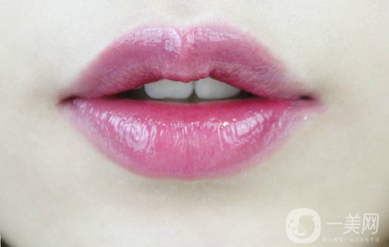 玻尿酸豐唇后會腫嗎？玻尿酸豐唇注意事項(xiàng)