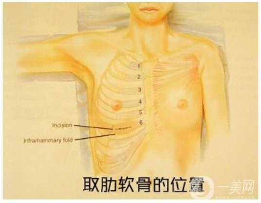 自體肋軟骨隆鼻危害有哪些？隆鼻價(jià)格