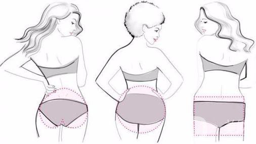 玻尿酸豐臀需要多少錢