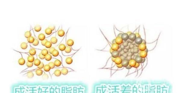 怎么讓脂肪成活率高一點 影響成活率的因素