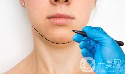 自體脂肪豐下巴怎么樣？?jī)?yōu)勢(shì)有哪些？