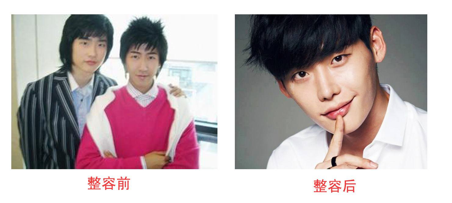 李鐘碩承認(rèn)整容：李鐘碩整容前后照片