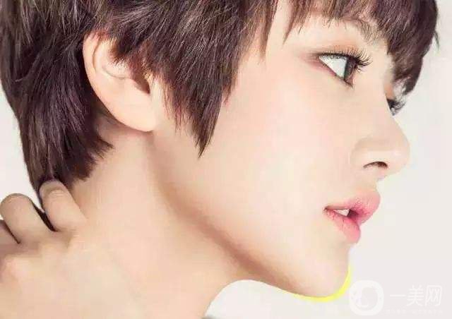 脂肪墊下巴好嗎 恢復(fù)時(shí)間是多久