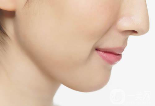 脂肪墊下巴好嗎 恢復(fù)時(shí)間是多久