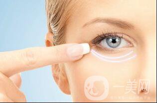 自體脂肪填充淚溝