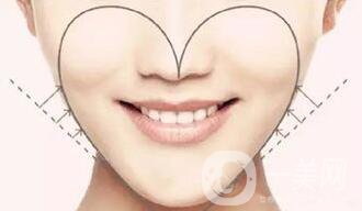 自體脂肪墊下巴多少錢