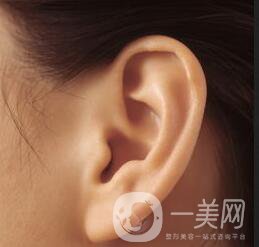 自體脂肪豐耳垂