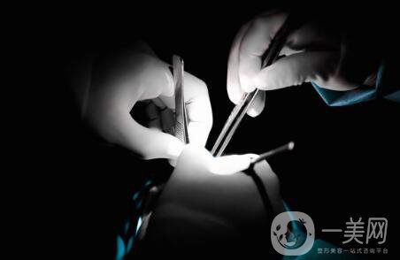 軟骨隆鼻能保持多久？軟骨隆鼻怎么樣？