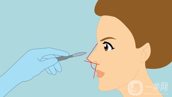 *修復(fù)恢復(fù)很慢嗎 *修復(fù)傷害大不大