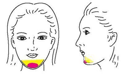 自體脂肪豐下巴能維持多久時(shí)間 多少錢(qián)呢？