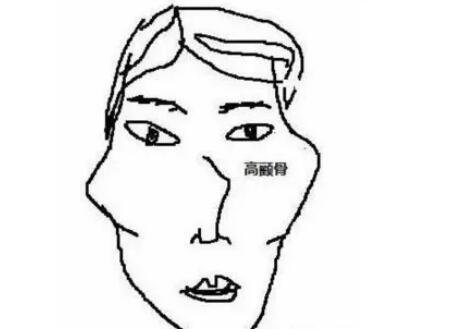 顴骨內(nèi)推術(shù)