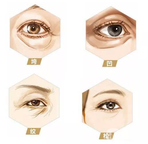 *需要多少錢 *的材料怎么選擇