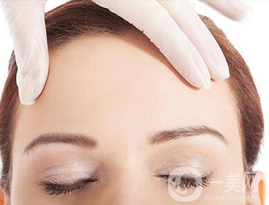 額頭自體脂肪,保持多久