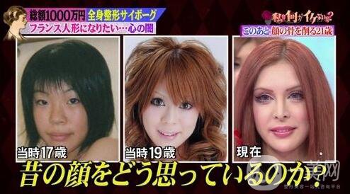 日本女人做整形手術(shù)：想成為活的“法國(guó)娃娃”