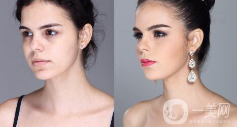 整容手術(shù)：事先要知道什么？