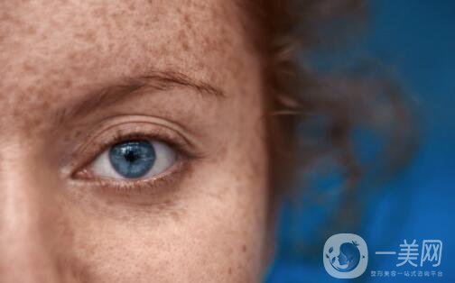 激光祛斑幾天可以洗臉？激光祛斑注意事項