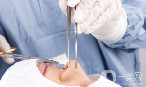 隆鼻手術(shù)有什么*果？它的風險有哪些？