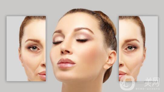 臉部哪里容易長皺紋？臉上皺紋怎么去除