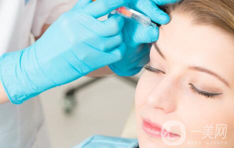 臉部哪里容易長皺紋？臉上皺紋怎么去除