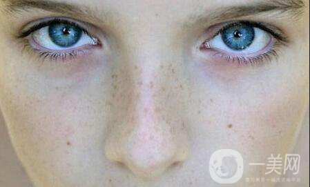 黑頭,白頭,區(qū)別