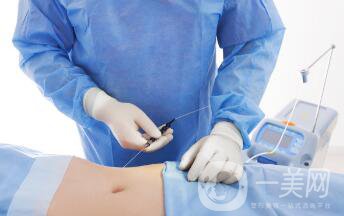 等離子激光溶脂怎么做?激光溶脂手術(shù)過(guò)程詳解