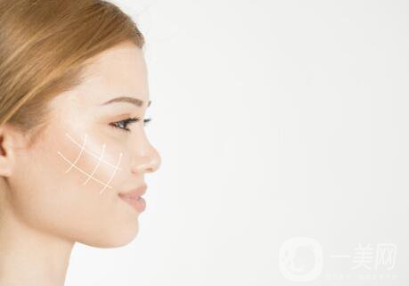 伊婉玻尿酸多少錢一支？玻尿酸每個部位用量