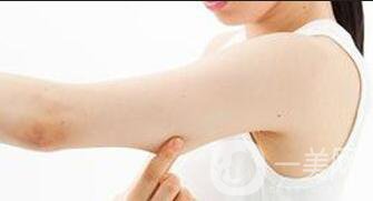手臂舉升手術康復