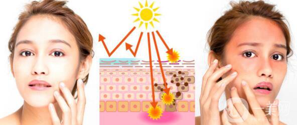 如何快速治好曬傷?來(lái)自*皮膚科醫(yī)生的15個(gè)提示