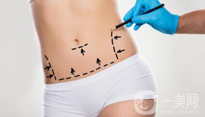 環(huán)形吸脂減肥是什么？吸脂后皮膚會(huì)不會(huì)松弛？
