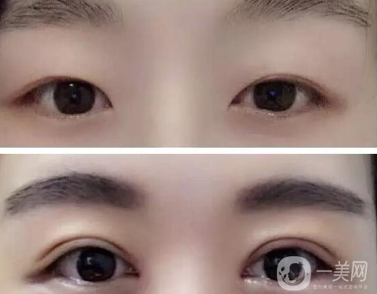 楊曉楠：整形外科界大咖 讓你的眼睛會說話