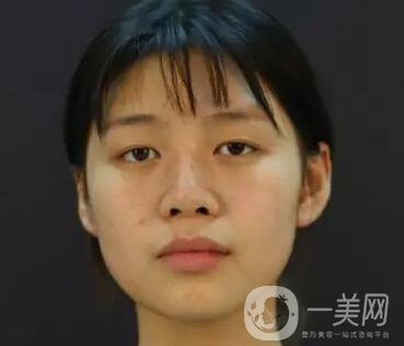 石家莊整形美容信息介紹？美聯(lián)臣整形怎樣？美聯(lián)臣價(jià)格