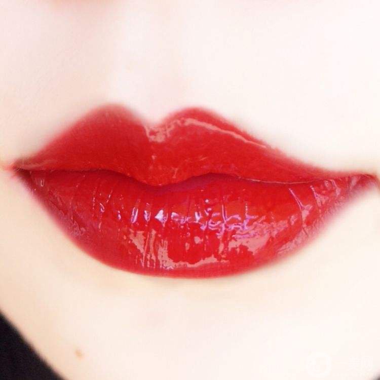 看看打玻尿酸豐唇腫脹圖片 玻尿酸豐唇多久消腫