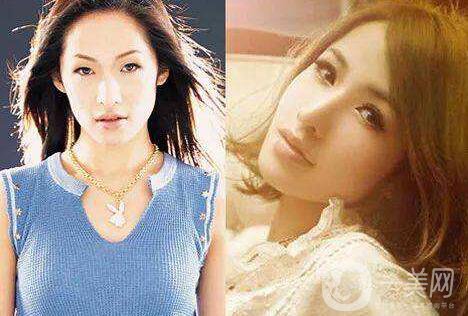 成都眼部整形專題 明星眼部整形