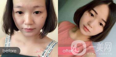 成都紋眉價格 成都現(xiàn)在文眉多少錢?