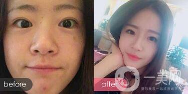 成都紋眉價格 成都現(xiàn)在文眉多少錢?