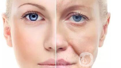 拉皮除皺的價(jià)格