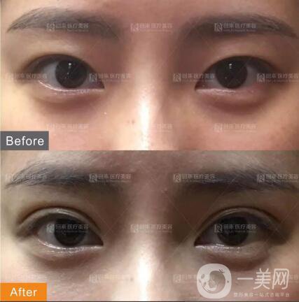 深圳回來醫(yī)療案例