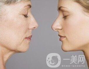 除皺的方式有哪些？