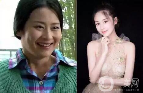 韓式共振吸脂減肥