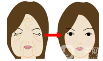 電波拉皮除皺術(shù)要做幾次 有人做過(guò)電波拉皮嗎